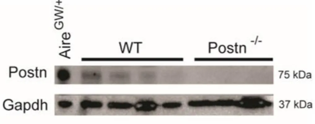 Figure 3. 3: Postn protein is absent in NOD.Postn -/-  mice. Postn expression was  measured by Western blot from sciatic nerve lysates from NOD.Aire GW/+  neuropathic,  NOD.WT (WT), and NOD.Postn -/-  mice