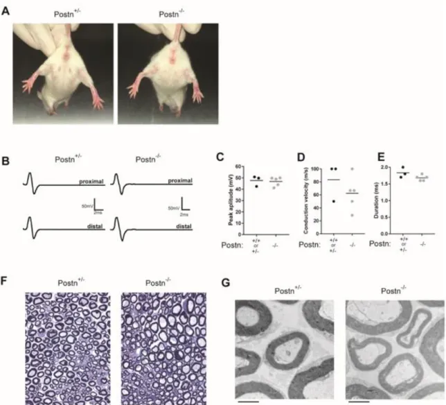 Figure 3. 10: Postn deficient mice have normal peripheral nerves. A) Clinical  evaluation of NOD.Postn +/-  and NOD.Postn -/-  mice