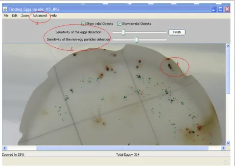Figure 4 Advanced graphical user interface. ‘c’ signals the advanced features for changing the automatic threshold and chroma value