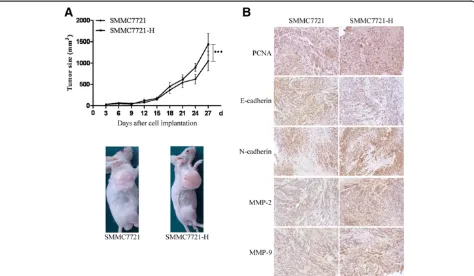 Figure 4 Insufficient RFA promoted the growth of HCC cellsData were presented as the mean tumor volumes of mice