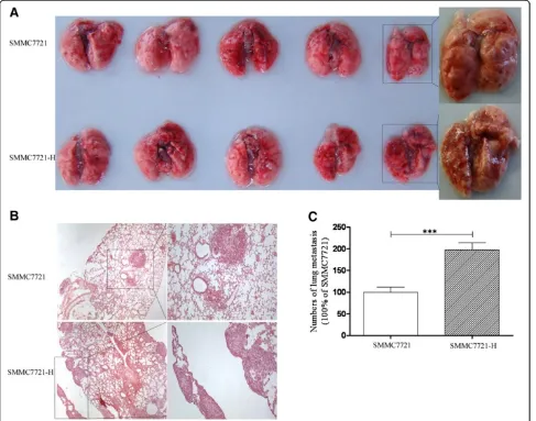 Figure 5 HCC cells after insufficient RFA exhibited enhanced metastatic ability in vivo