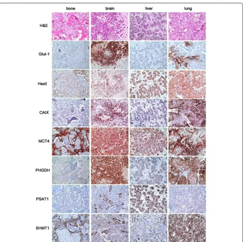 Figure 1 Differential expression of metabolism-related proteins in breast cancer metastasis according to metastatic site