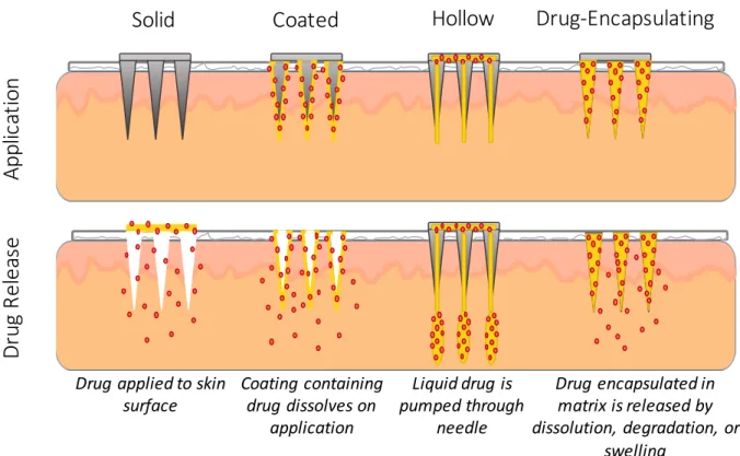 Figure 1.2 Microneedle Classes. Application and drug release method of solid, coated, hollow,  and drug-encapsulating microneedles