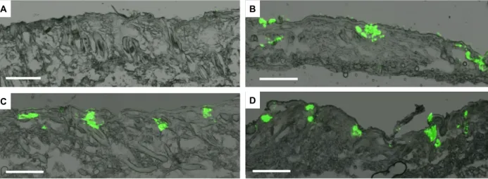 Figure 2.13 Ex Vivo Particle Release. Murine skin after treatment with (A) unmodified 80x320  nm particle pre-microneedle film, (B) unmodified 80x320 nm particle microneedles, (C) 