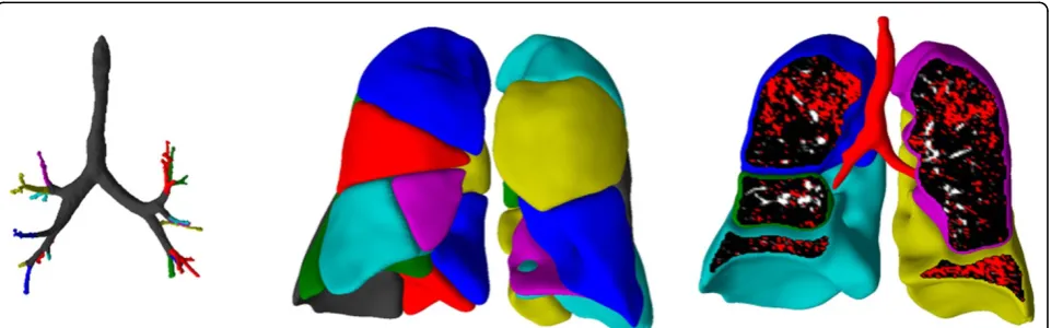 Figure 1 Combined image-processing and modeling results from a CT scan of a patient with COPD from the Synergy-COPD project.Segmentation of (A) central airways and (B) segments (calculated using both image processing and modeling approaches, color coded by