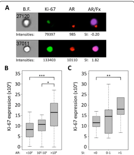 Figure 6 Correlation of AR expression or nuclear localization withexpression of the proliferation marker Ki-67