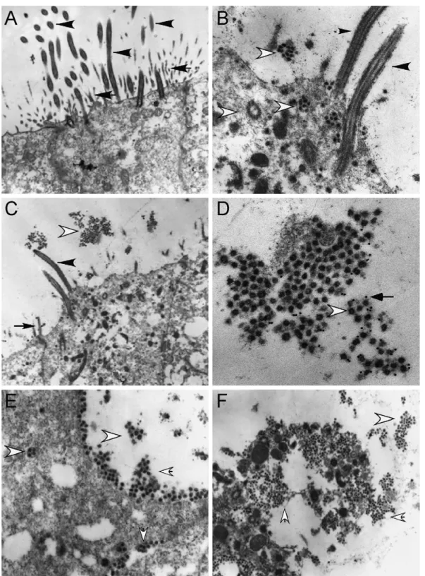 Fig. 2. Ultrastructural localization of SARS-CoV in HAE. Representative transmission electron microscopic photomicrographs of HAE infected with Urbani SARS- SARS-CoV