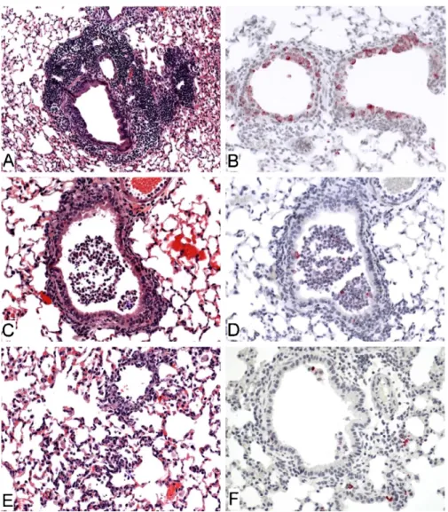 Fig. 2. Histopathologic features of infection with SARS-CoV in the lungs of aged 129S6, B6 and BALB/c mice at 3 days post-infection