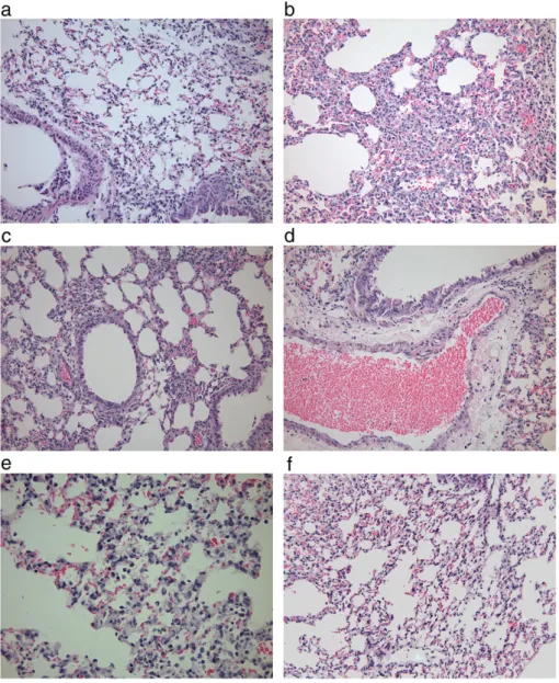 Fig. 4. Histological slides showing representative lung pathology. (a) Urbani-infected lung with no signiﬁcant changes (40×)