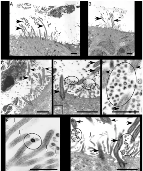 FIG. 7. Ultrastructural localization of HCoV-HKU1 in HAE. Representative transmission electron photomicrographs of HAE inoculated with HCoV-HKU1