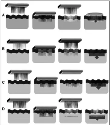 Figure 1.4 Schematics of the application strategies for the four main configurations of microneedle devices