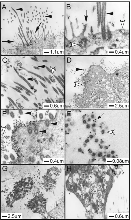 FIG. 6. Ultrastructural localization of SARS-CoV in HAE. Representative transmission electron microscopic photomicrographs of HAE infected with Urbani SARS-CoV