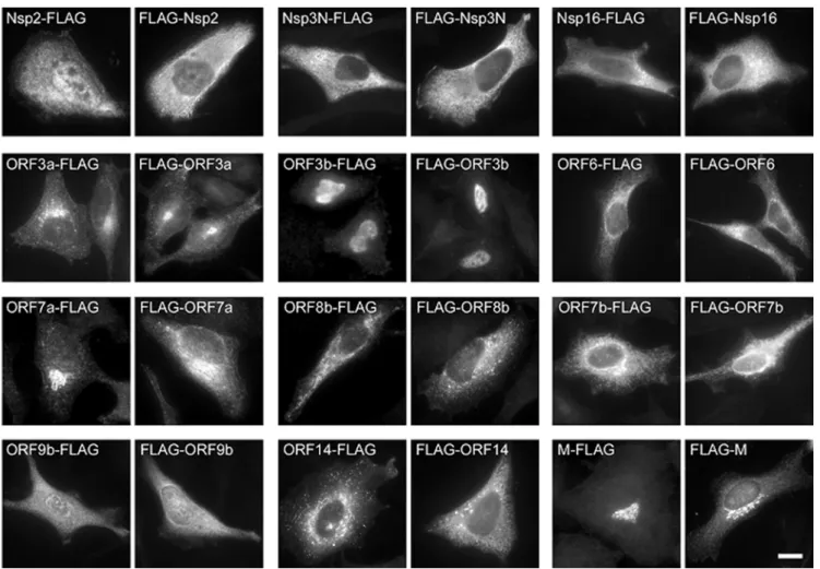 Figure 5. Subcellular localization analysis of SARS-CoV ORFs. Expression plasmids containing N- and C- terminally FLAG -tagged ORFs were transfected into Hela cells and analysed after 24 hours with an anti- FLAG antibody for expression and localization of 