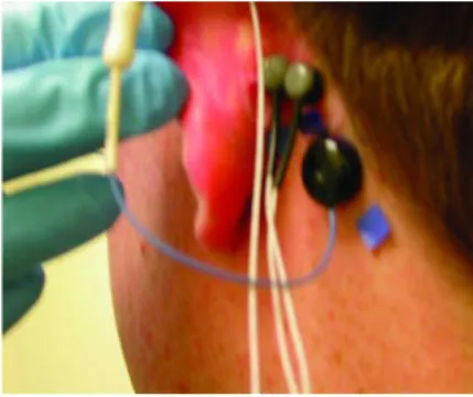 Figure 1: Sensor placement for postauricular reflex recording 