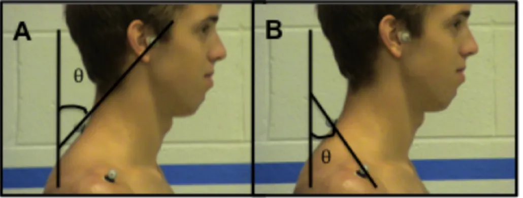 Figure 7: Forward Head and Shoulder Angles 
