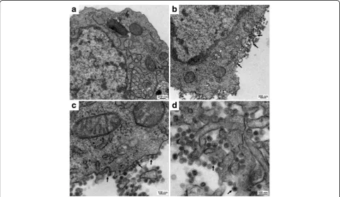 Fig. 1 TEM of mock (200 nm;a) and BR/P05 (b-d) C6/36 infected cells at 48 h post-infection