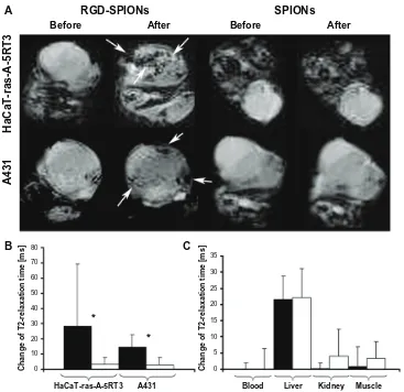 Figure 1 MR imaging of tumors with different αvβ3 expression profiles. (A) T2*-weighted MR images of nude mice bearing subcutaneous HaCaT-ras-A-5RT3 (top row) and A431 tumors (bottom row) before and 6 hours after iv injection of RGD-SPIONs and SPIONs, resp