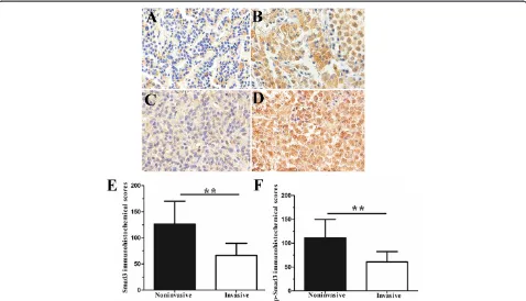 Figure 2 Immunohistochemical analysis of Smad3 and p-Smad3. (A)NFPA (case 2). Low Smad3 expression in invasive NFPA (case 1)