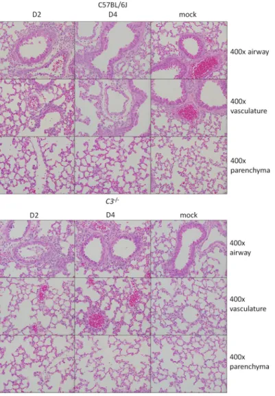 FIG 3  Histological analysis of C57BL/6J and C3 ⫺/⫺  lungs at 2 and 4 days postinfection