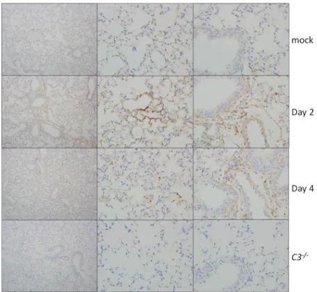 FIG 4  Complement deposition staining. Complement deposition on lung tissue of C57BL/6J mice (top  three  rows)  was  assessed  by  immunohistochemistry