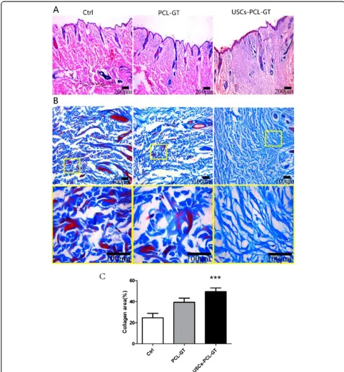 Figure 5 Histological analysis of rabbit wounds on day 14. (A) Wound histological images (H&E stain); (B) Masson’s trichrome staining, thebottom shows an enlarged view of the region inside the box; (C) Areas of collagen were quantified in day 14 wounds (Im