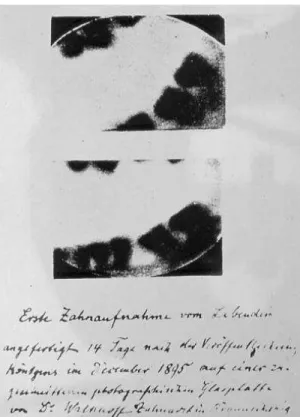 Fig 1: First dental x-ray. © Google: https://www.google.com/search?q=first+dental+x+ray