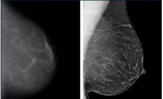 Figure 7. Visual Comparison of Digital and Film Mammography  75