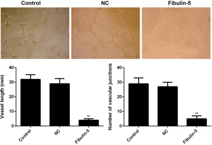 Figure 5. Inhibitory effect of Fibulin-5 on vessel-sprouting abilities of HUVEC-2C cells