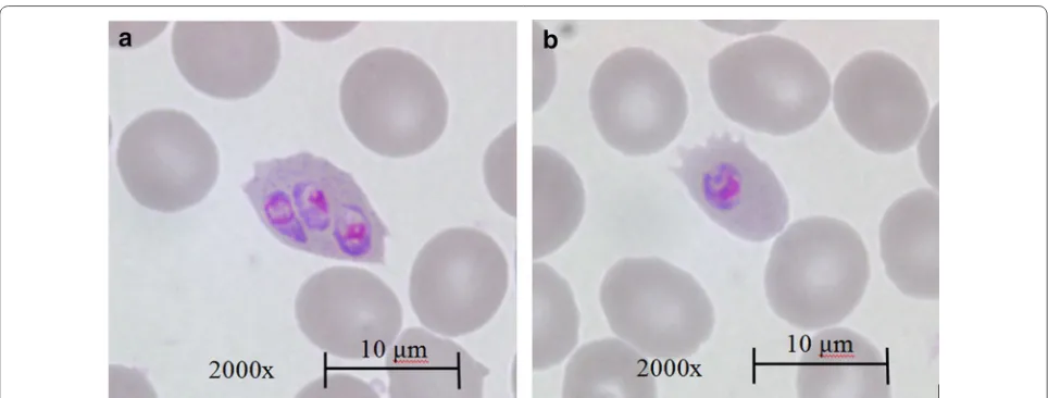 Fig. 2 Giemsa-stained microscopy of pling in Plasmodium ovale. Note prominent Schüffner’s stippling in a, compared to the absence of Schüffner’s stip-b