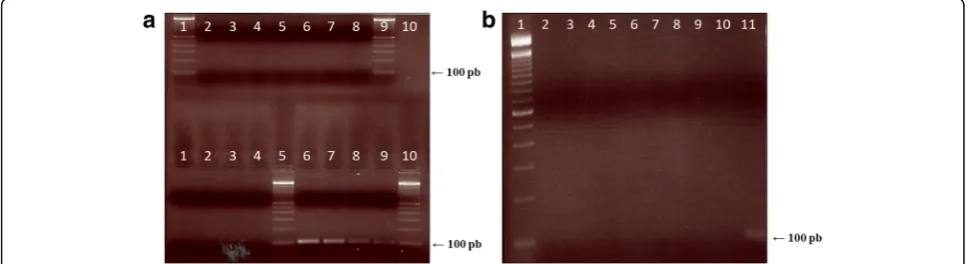Fig. 3 Limit of detection of T. cruzi in açai samples with primersTc189F/Tc189R. T. cruzi DNA (from 75 pg to 2.4 pg) was mixed with240 ng of açai DNA before the PCR assay using Tc189F/189Rprimers