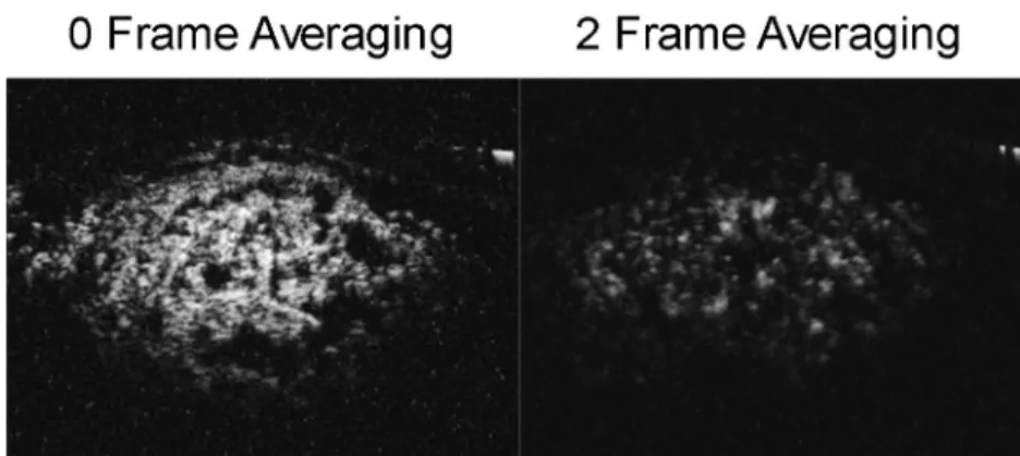 Figure 3. 3. The effect of frame averaging on AA images. The AA image on the left was 