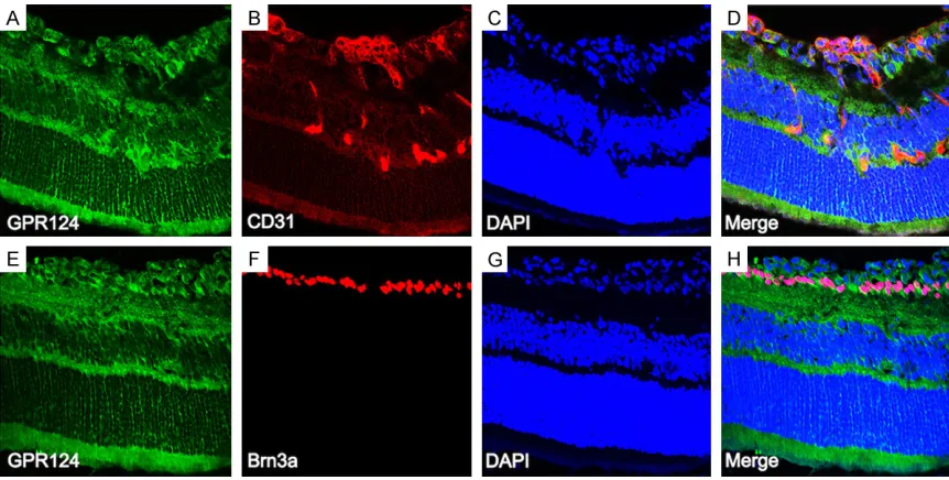 Figure 6. Immunofluorescence localization of GPR124 in the OIR mice retina at P17. Mice retinal frozen sections at P17 from OIR group were immunostained with GPR124 (A, E; green), CD31 (B, red), Brn3a (F, red), DAPI (C, G; blue), and Merge (D, H; yellow)
