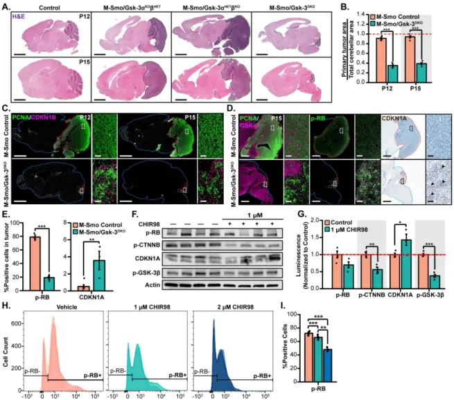 Figure 2.7. GSK-3 is required for Shh-driven medulloblastoma tumor growth. (A) Comparison of  cerebellar regions in M-Smo/Gsk-3 DKO  mice and Gsk-3 intact Smo-mutant in representative H&amp;E-stained  cerebellar sections at P12 and