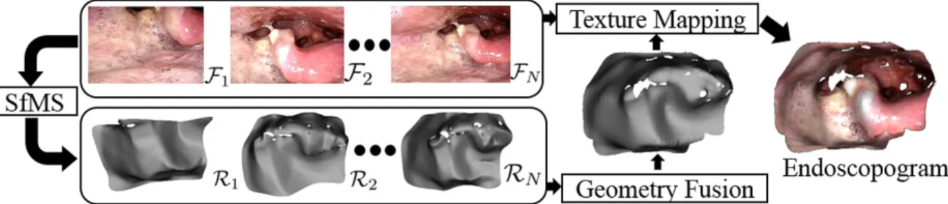 Figure 3.2: An endoscopogram is constructed via non-rigid registration of multiple SfMS recon- recon-structions of individual video frames.