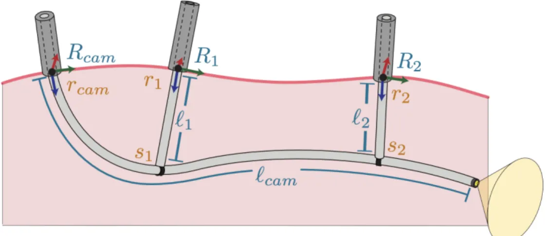 Figure 3.3: Highlighting the differences between the CRISP robot’s design parameters and configura- configura-tion variables: The CRISP robot’s kinematic design parameters (orange), which must be set before a procedure, include the entry points into the bo