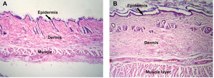 Figure 7 Low intensity photomicrograph of a skin section from (A) a control animal and (B) an animal subcutaneously administered PLA-PEG nanoparticles.Abbreviations: PEG, poly(ethylene glycol); PLA, polylactic acid.