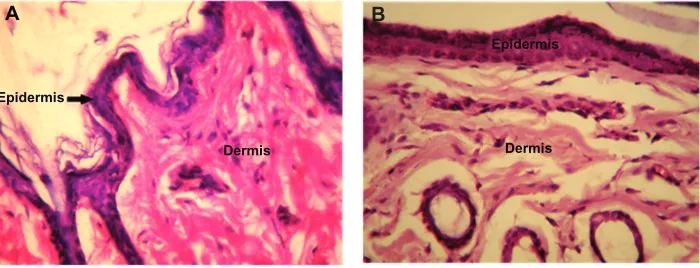 Figure 8 High intensity photomicrograph of a skin section from (A) a control animal and (B) an animal subcutaneously administered PLA-PEG nanoparticles.Abbreviations: PEG, poly(ethylene glycol); PLA, polylactic acid.