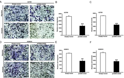 Figure 3. Effect of GAS5 on migration and invasion in ovarian cancer cells. A. Costar chamber assay was performed to study the influence of GAS5 on migration and invasion of A2780 cells