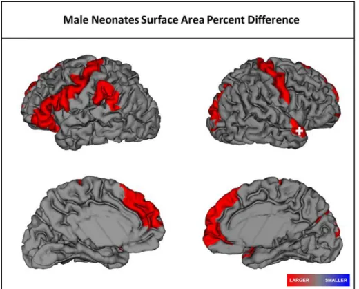 Figure 2.2 Significant regional differences in surface area in male SCZHR neonates when compared to Controls