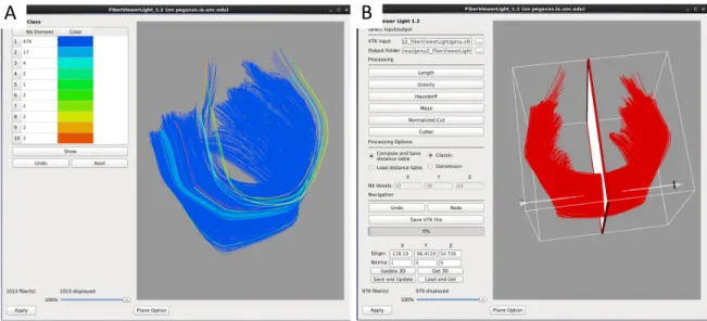 Figure 2.6: FiberViewerLight clustering, cleaning, and plane creation. A.) Example of genu fiber clustering based on the center of gravity