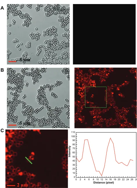 Figure S6  Fluorescence responses measured by LSCM when different concentration of anti-H5N1 (1:2000, 1:3000, 1:4000 and 1:5000) reacted with 30 ng/mL HAQ.