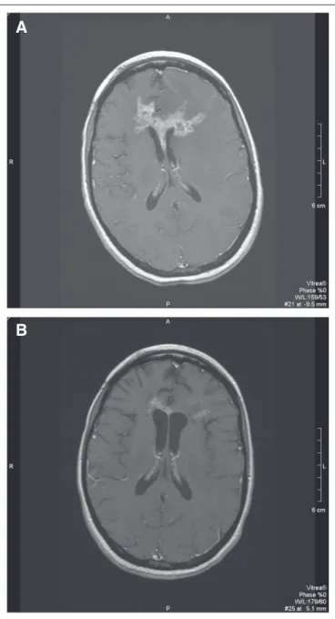 Table 3. Overall CNS Activity Rate for Lapatinib