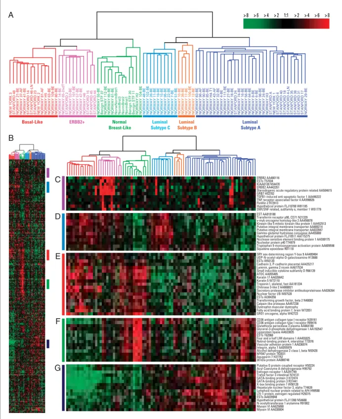 Fig 1. Gene expression patterns of 85 samples (78 carcinomas, three benign tumors, four normal tissues) analyzed by hierarchical clustering using the 476 cDNA intrinsic clone set