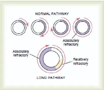 Fig 2.2 Comparison of Normal Impulse Pathway (Top) with Long Impulse Pathway (Bottom)  1 On the other hand, shorter pathways can have the problem of the impulse reaching  itself, with little or no non-refractory gap