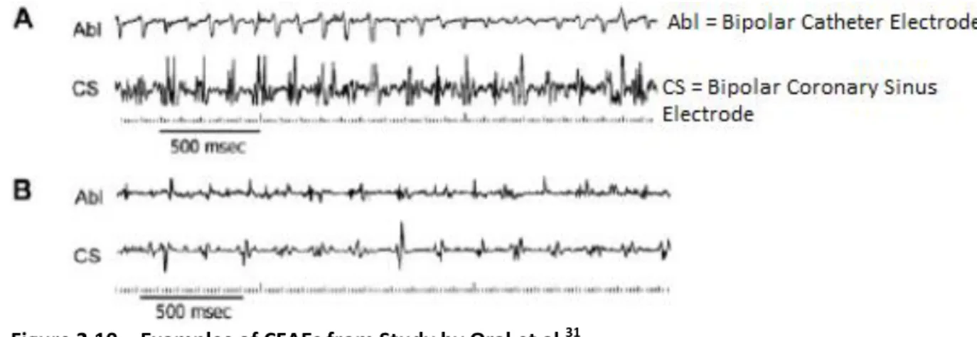 Figure 2.10 – Examples of CFAEs from Study by Oral et al. 31