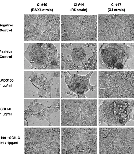 Figure 4clinical isolates CI #10, CI #14 and CI #17, which each have a different coreceptor use as shown between bracketsMicroscopic view of cytopathic effect (giant cell formation) at day 5 after infection of U87.CD4.CCR5.CXCR4 cells with the Microscopic 