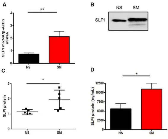 Figure 2-1. SLPI mRNA and protein secretion from in vitro and in vivo samples. 