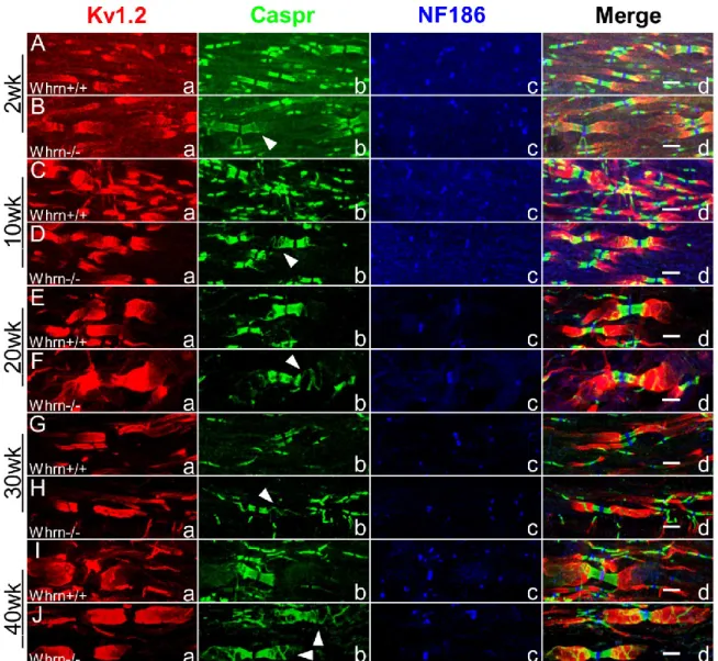 Figure 3.4. Loss of Whirlin contributes to abnormal paranodal compaction throughout  development in the spinal cord