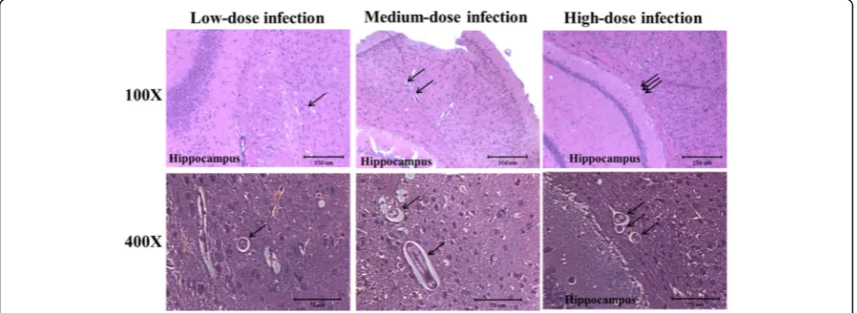 Fig. 3 Toxocara canis larvae recovered from mouse brains with low-,medium- and high-dose infections at 10 days post-infection (dpi)and 8, 16 and 20 weeks post-infection (wpi)