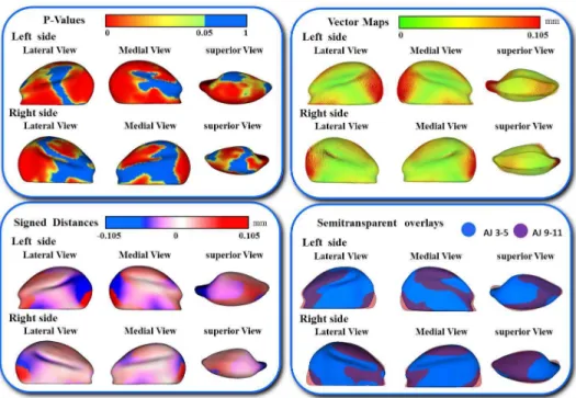 Figure 8: Shape analysis of morphological differences between A/J 3-5 week and 9-11  weeks old mice mandibular condyles